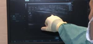 Pedro Nogales y Raúl Ramos radioterapia