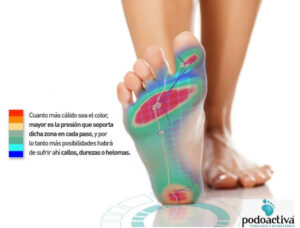 presiones en huella plantar